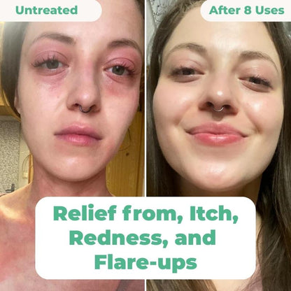 The Complete Eczema Repair System 2.0