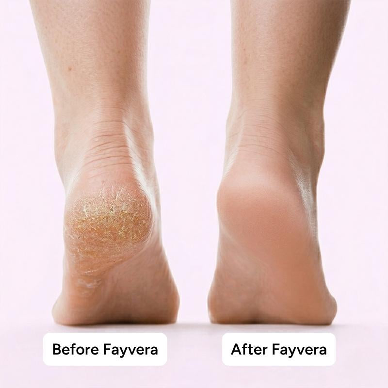 Get salon smooth, baby soft feet at home in minutes with Fayvera